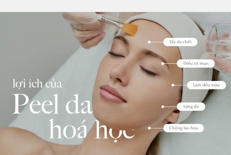 Điều trị nám da bằng phương pháp IPL