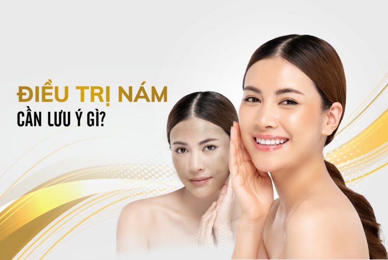 Nám da cần phải được điều trị tích cực và khoa học để mang đến hiệu quả 