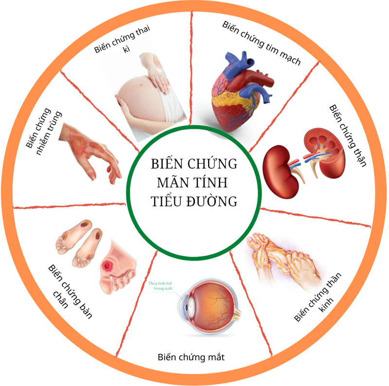 ngăn chặn biến chứng của bệnh tiểu đường