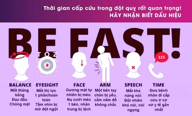 Cần lưu ý những dấu hiệu cảnh báo đột quỵ và phòng ngừa từ sớm