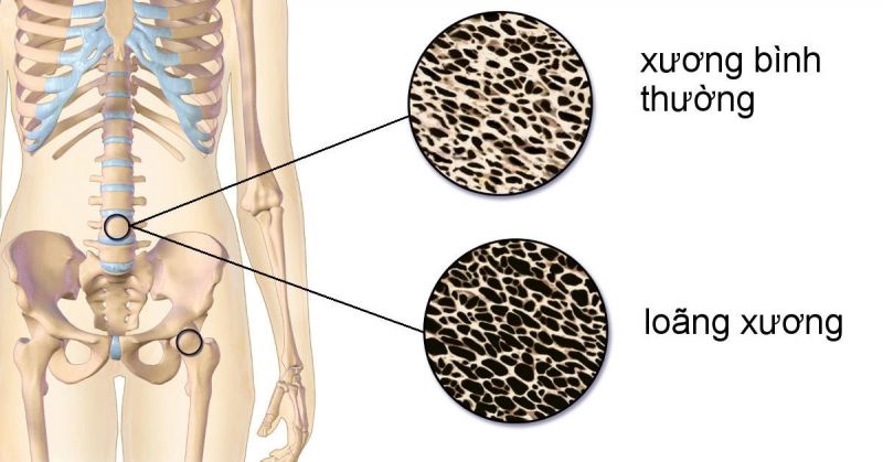 uống canxi xong uống nước cam được không
