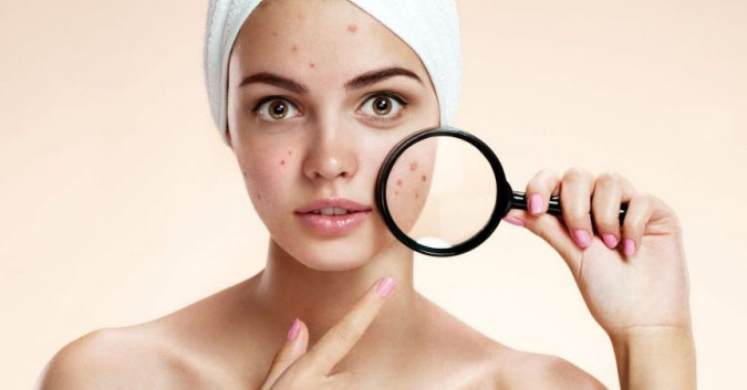Những sai lầm cần tránh khi chăm sóc da mụn nhạy cảm
