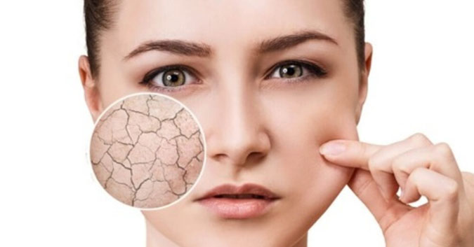 Bổ sung collagen dưỡng ẩm cho da khô là điều cần thiết