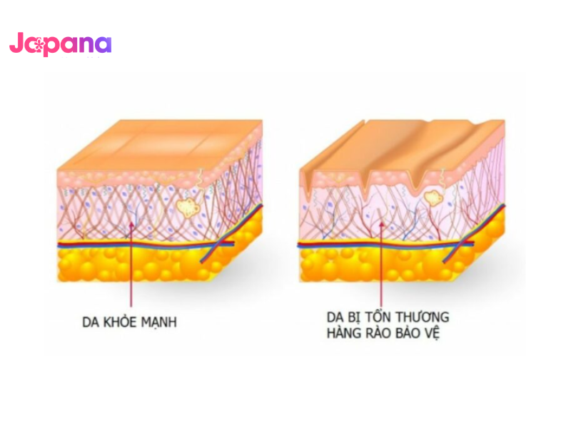 hàng rào bảo vệ da