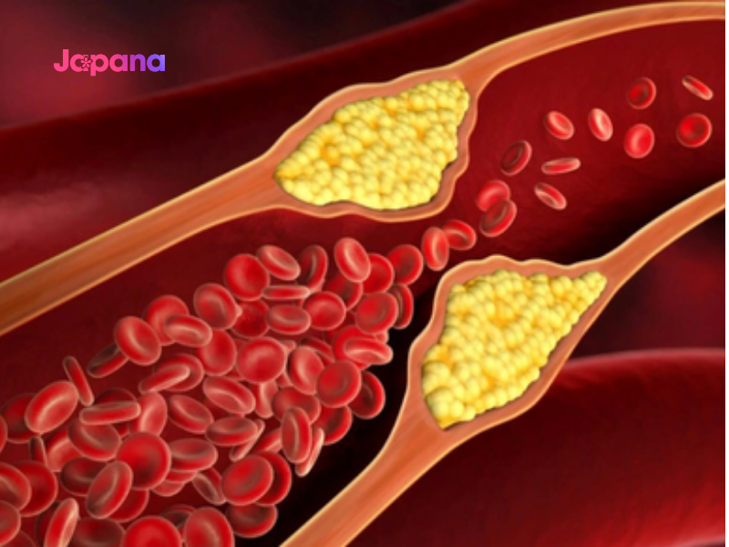 Tại sao nên sử dụng viên uống giảm mỡ máu của Nhật?