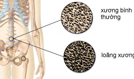 Uống canxi xong uống nước cam được không? Tại sao?