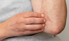 Vì Sao Uống Thải Độc Gan Bị Ngứa Và Cách Khắc Phục