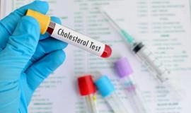 Chỉ số mỡ máu cao bao nhiêu là bình thường, bao nhiêu là nguy hiểm?