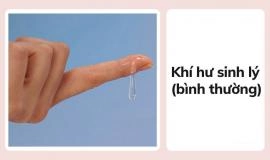 Khí Hư Âm Đạo Là Gì? Những Điều Cần Biết và Cách Chăm Sóc Tình Trạng Khí Hư