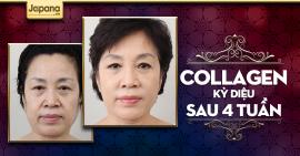 Tại sao collagen lại có nhiều công dụng đến vậy?