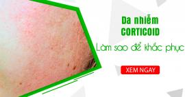 Da nhiễm Corticoid - Làm sao để khắc phục?