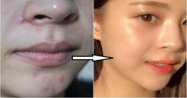6 thói quen tốt nên làm mỗi ngày để có làn da trắng sáng và không bị lão hóa