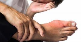 Top các loại thực phẩm tốt cho người bệnh Gout