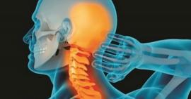 Mách bạn 3 cách chữa thoái hóa đốt sống cổ phổ biến nhất