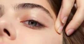 Phát hiện những căn bệnh tiềm ẩn bên trong cơ thể nhờ vị trí mụn mọc trên da