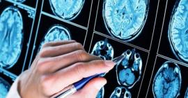 10 triệu chứng giúp nhận biết sớm bệnh Alzheimer