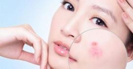 Uống collagen thế nào để không bị nóng?
