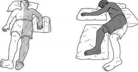 Thuốc điều trị tai biến liệt nửa người hiệu quả như thế nào?