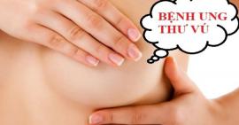 Những nguyên nhân dẫn đến bệnh ung thư vú và các biện pháp phòng ngừa bệnh