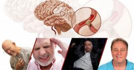 TOP 9 thuốc hỗ trợ điều trị tai biến mạch máu não tốt nhất hiện nay