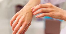 5 mẹo giúp mau lành sẹo đơn giản hiệu quả