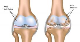 Thoái hóa khớp ở người cao tuổi