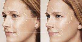 Xóa mờ nếp nhăn hiệu quả tại nhà không cần đi đâu xa