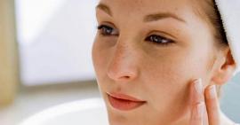 Cách trị nám da an toàn cho các bà mẹ bỉm sữa