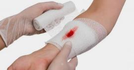 10 mẹo giúp vết thương mau lành tại nhà cực đơn giản