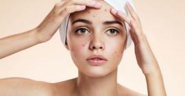 Da mụn ngày càng trở nên tệ hại vì những thói quen này