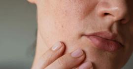 Thực phẩm dưỡng ẩm da vào thời thiết hanh khô