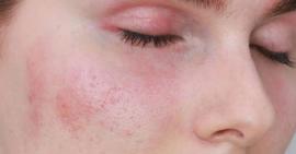 Tuyệt đối không được để các loại mỹ phẩm này tiếp xúc với da mặt bạn