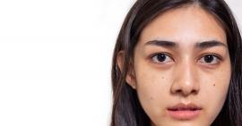 Stress ảnh hưởng đến da như thế nào?