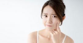 Nguyên nhân và cách phòng ngừa mụn ẩn dưới da