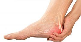 Đừng xem thường tình trạng đau gót chân