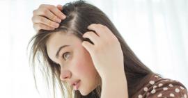 Tình trạng tóc có thể nói lên sức khỏe của bạn