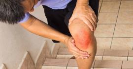 Tác hại và phương pháp điều trị bong gân khớp gối