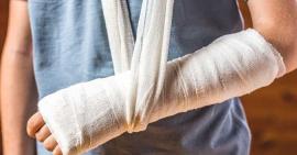 Hướng dẫn sơ cứu gãy xương nhanh chóng và an toàn