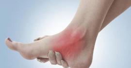 Cần sơ cứu và điều trị bong gân sớm để không có ảnh hưởng về lâu dài