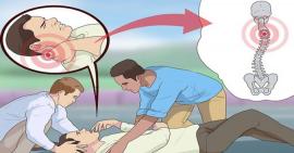 5 cách xử lý sai lầm sau chấn thương gãy xương thường gặp