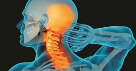Những điều bạn cần biết về thoái hoá cột sống cổ