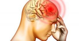 5 triệu chứng cảnh báo thiếu máu não và 3 loại thực phẩm giúp lưu thông máu bạn cần biết