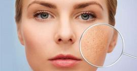 Làm sạch lỗ chân lông cho da luôn sáng mịn, sạch trơn chỉ bằng 4 mẹo nhỏ