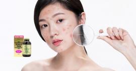 Tảo xoắn có trị mụn không?