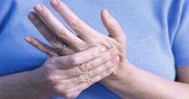 Nguyên nhân dẫn đến trật khớp bàn tay và cách xử lý