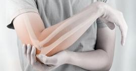 Phát hiện và điều trị sớm gãy chỏm quay