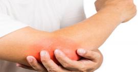 Điều trị và phục hồi khi bị gãy mỏm khuỷu 