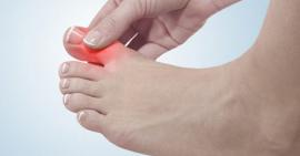 Chữa gout từ quả đu đủ và lá trà xanh hiệu quả khiến bạn không ngờ tới