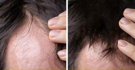 Giảm tóc gãy rụng với tuyệt chiêu của người Ấn Độ