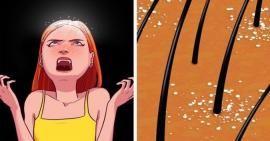 Tóc sẽ trở nên nhiều gàu hơn vì 12 thói quen này